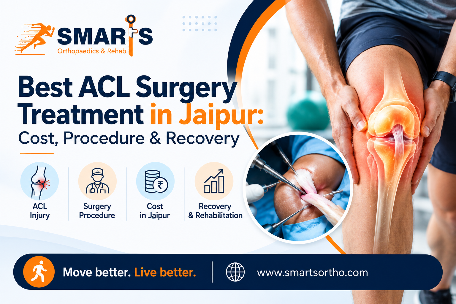 Best ACL Surgery Treatment in Jaipur: Cost, Procedure & Recovery